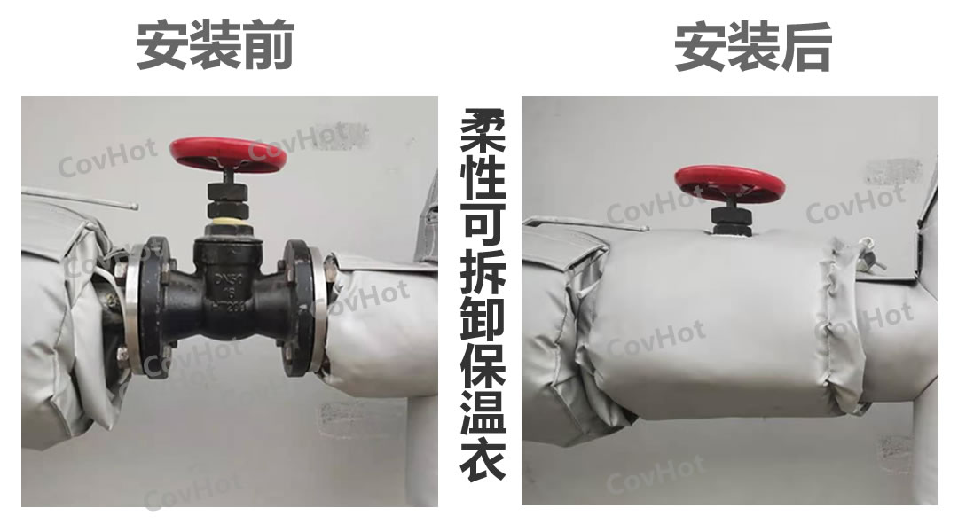 可拆卸式<a href=http://m.bizmedical.cn/e/tags/?tagname=%E6%9F%94%E6%80%A7%E4%BF%9D%E6%B8%A9%E8%A1%A3 target=_blank class=infotextkey>柔性<a href=http://m.bizmedical.cn/e/tags/?tagname=%E4%BF%9D%E6%B8%A9%E8%A1%A3 target=_blank class=infotextkey>保溫衣</a></a>